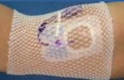 BANDAGE, TUBULAR ELAS NET 8" KIT (100/BG 5BG/CS)