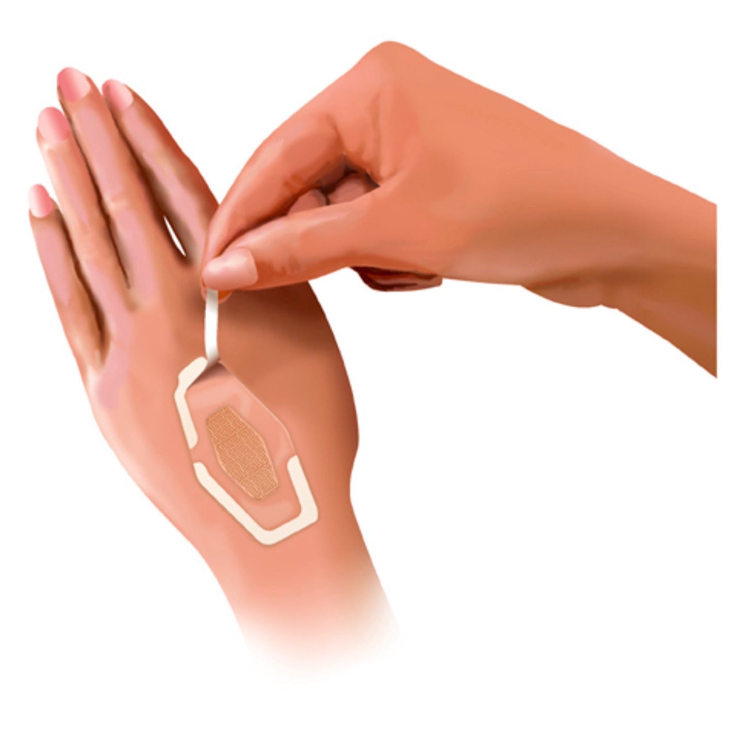 BANDAGE, NEXCARE WATERPROOF ASSORTED CLR (20/BX)