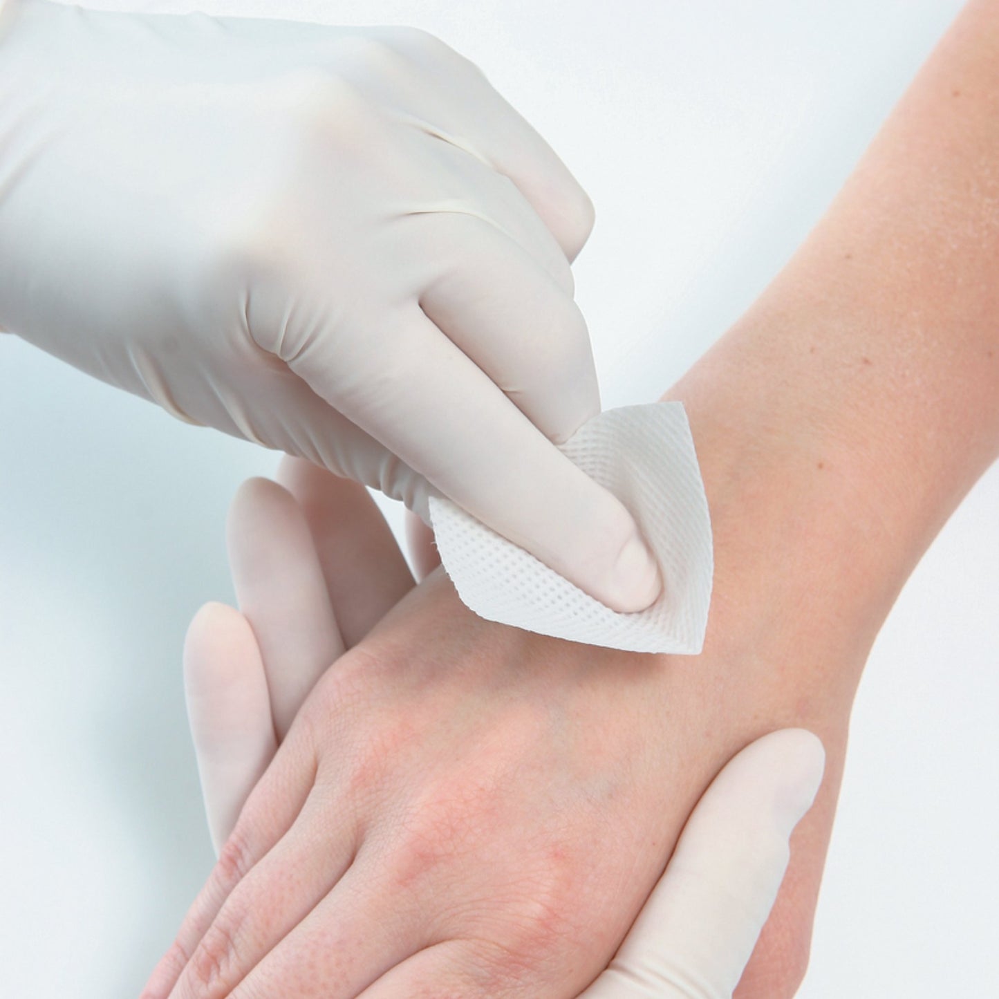 PAD, ADHSV TAPE REMOVER (100/BX)