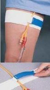 STRAP, CHAS CATH MATE (48/CS)