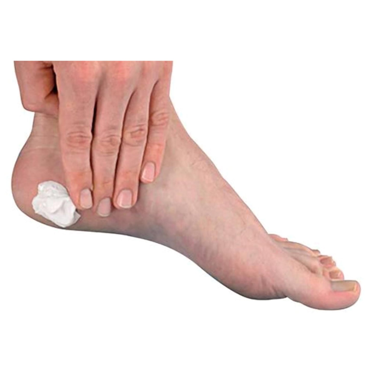 CREAM, CALLUS CONTROL 4OZ