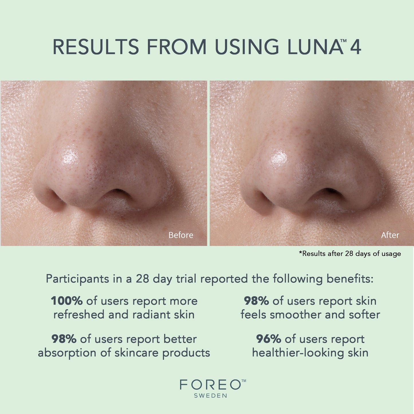 BRUSH, MASSAGE LUNA 4 FACIAL TSONICTM CLEANSE/FIRMING