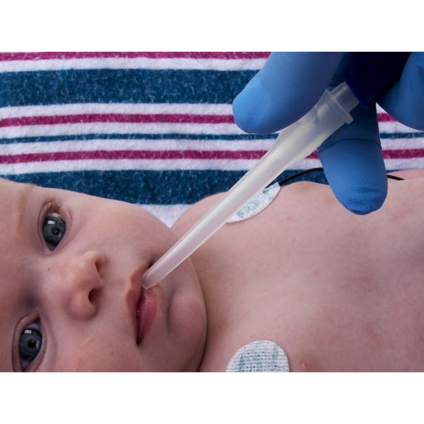 CATHETER, SCTN ORAL & NASAL DEVICE (50/CS)
