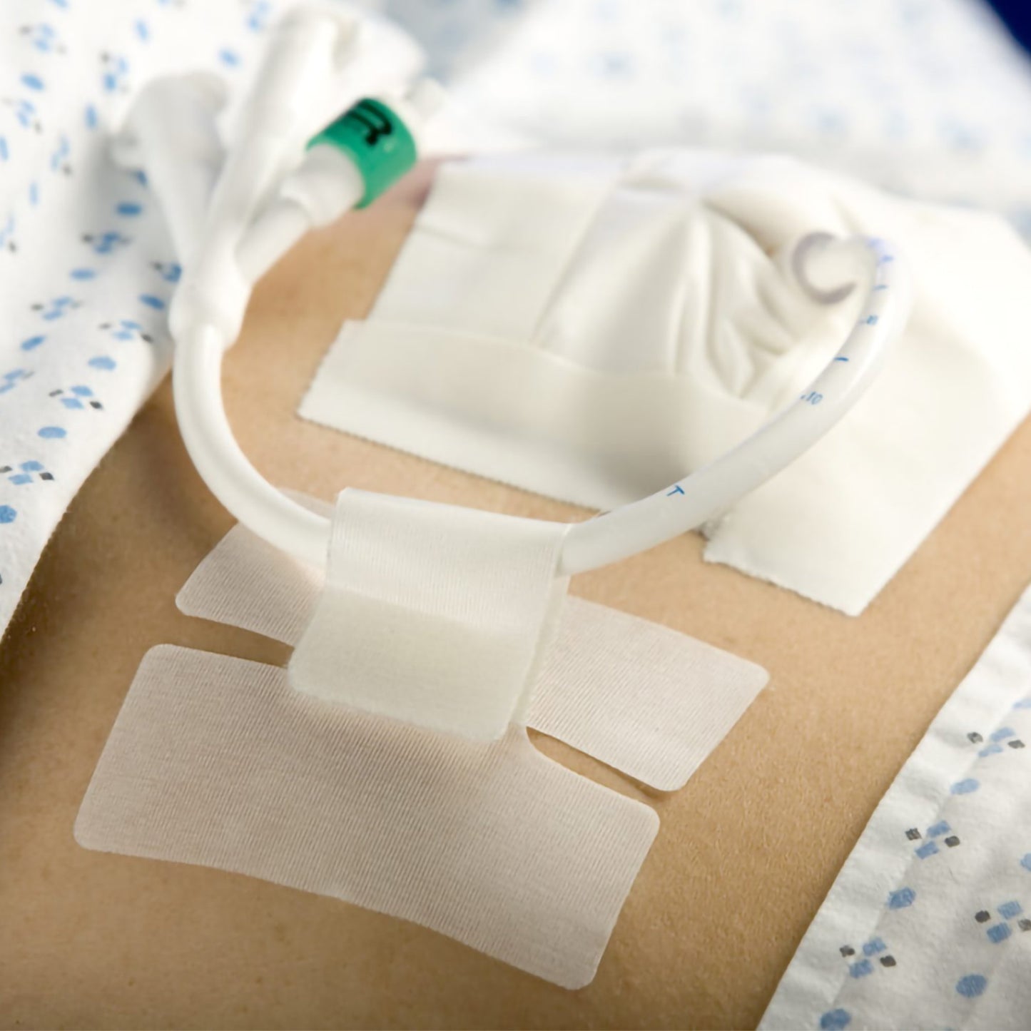 HOLDER, TUBE CATH-SECURE (50/BX 8BX/CS)