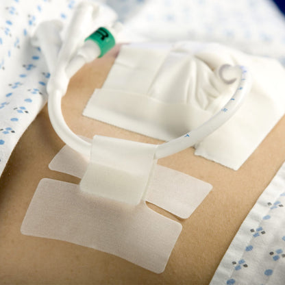 HOLDER, TUBE CATH-SECURE (50/BX 8BX/CS)