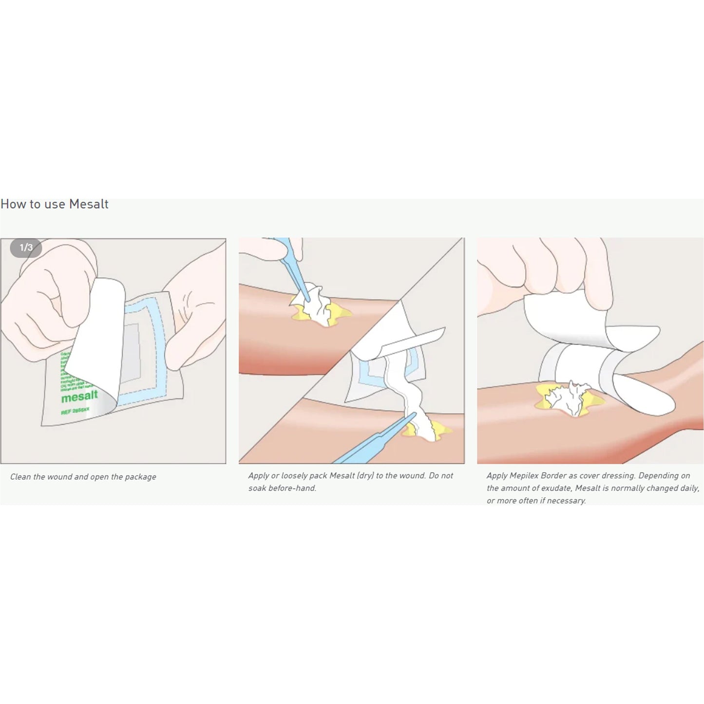 DRESSING, MESALT NACL STR 6X6 (30/BX 8BX/CS)