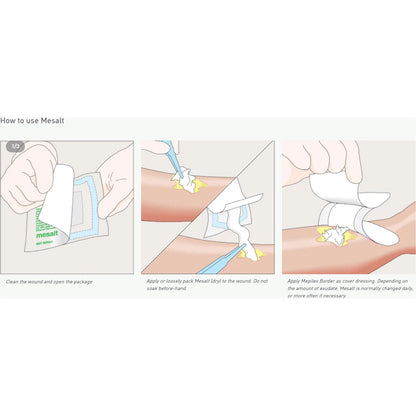 DRESSING, MESALT NACL STR 6X6 (30/BX 8BX/CS)