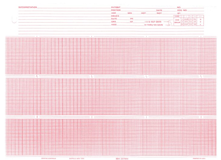 PAPER, ECG F/007944 8.5"X150' (20RL/CS)