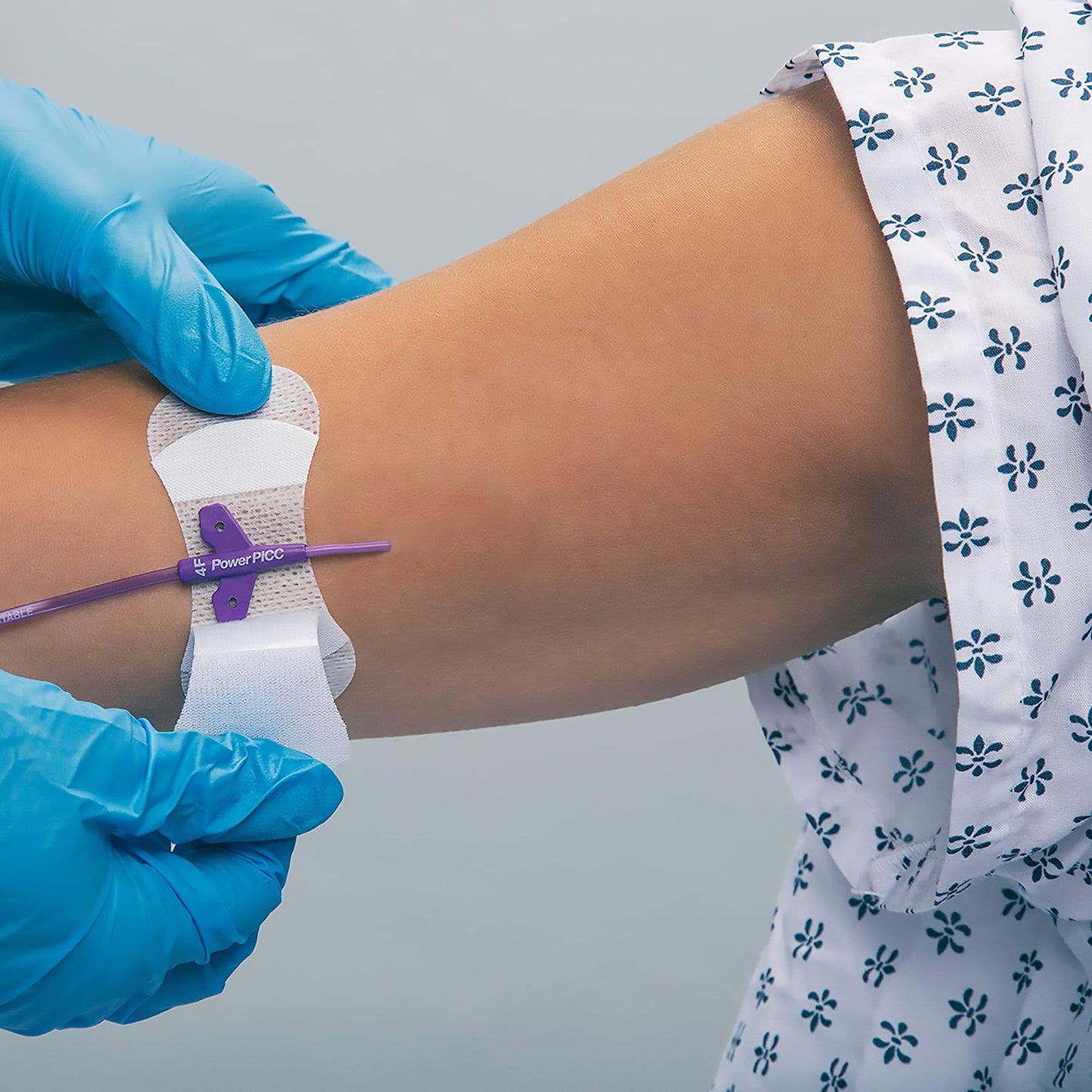 SECUREMENT, CATHETER/PICC GRIP-LOK MED (100/BX)