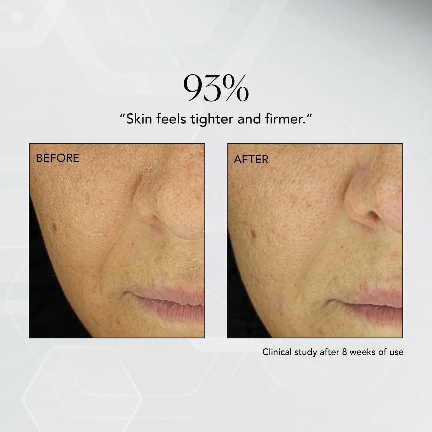 CREAM, FACIAL MD ADVANCED HYDRATING 1.7OZ (24/CS)