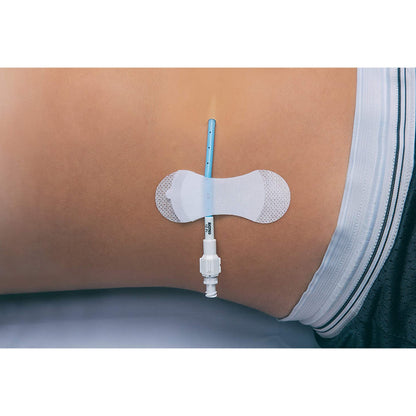 SECUREMENT, CATHETER/PICC GRIP-LOK MED (100/BX)