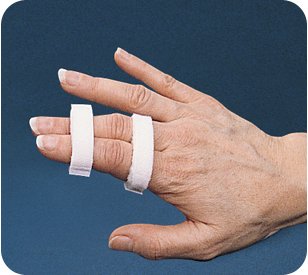 FINGER SPLINT, BUDDY HOOK LOOPSMALL 1/2" (10/PK)