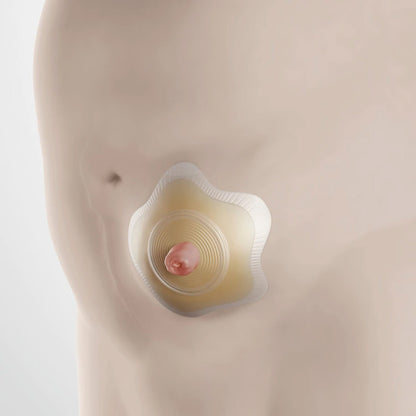 BARRIER, OSTOMY SENSURA MIO CLICK 2PC RED 1 3/16" (5/BX)