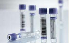 TUBE, BLD COL K3EDTA LAV/BLK 4ML PET VACUETTE (50/BX 24BX/CS