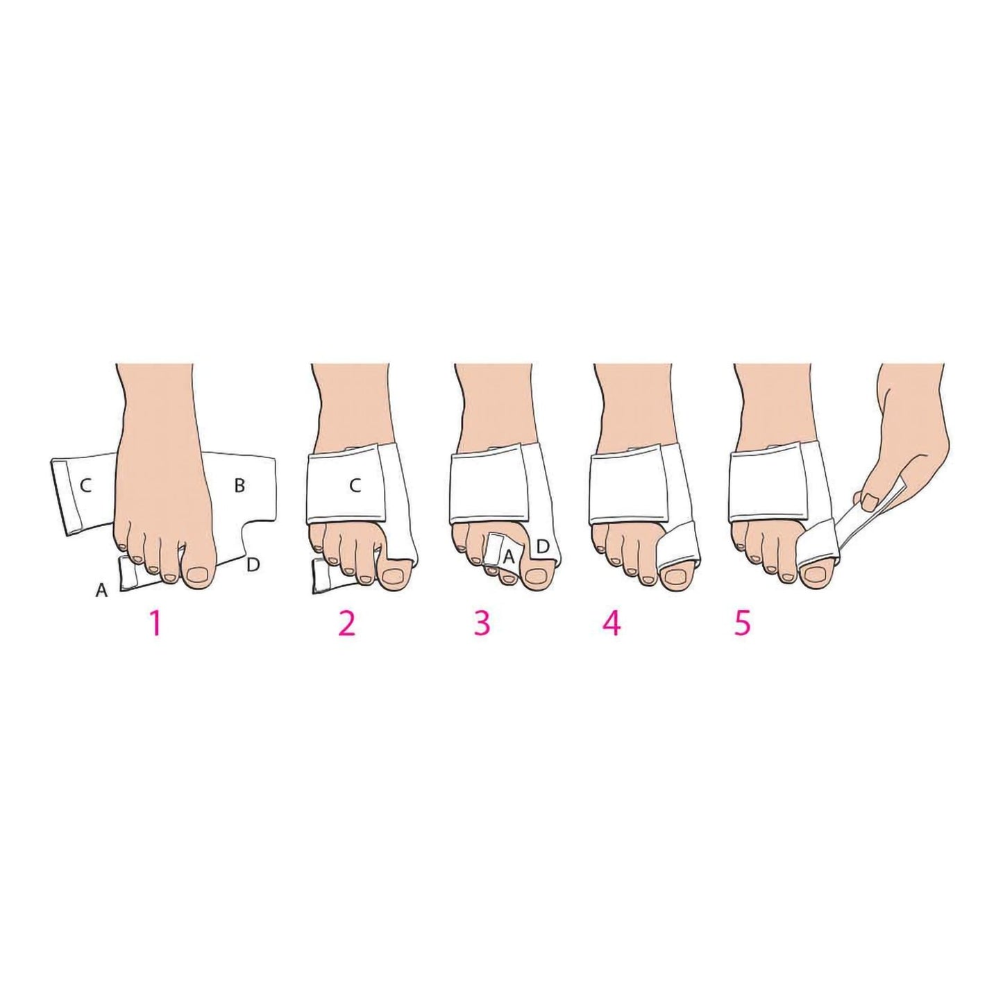 BUNION SPLINT MED/LFT SOFT POST OP