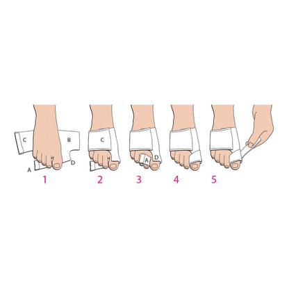 BUNION SPLINT MED/LFT SOFT POST OP