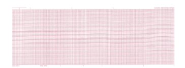 PAPER, ECG F/9402-023 4.25"X75' (2RL/BX 9BX/CS)